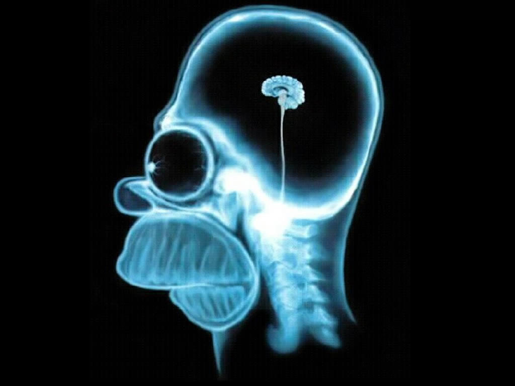 Homer-Brain-X-Ray-the-simpsons-60337_1024_768.jpg